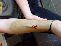 arm2